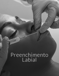 preenchimento labial